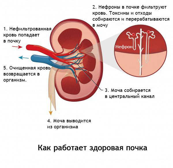 prxpxlf9le5rvqp7rpusis 57cgeba5xg mi7 wyolthqxoyu6wauavupoh9ydy zculllj9e607l5qd5yfrldek04duolfwqgsbae5ri4mn01jvoacy3dh1euzr8zlh kviikue Как работает здоровая почка:
1. Кровь попадает в почку
2. Нефроны фильруют кровь. Тоскины и отходы собираются и перерабатываются в мочу.
3. Моча собирается в центральный канал.
4. Моча выводится из организма.
5. Очищенная кровь возврашается в организм.